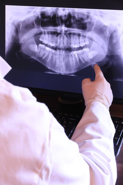 Best Emergency Dentist for Lost Fillings or Crowns in Monticello, IN